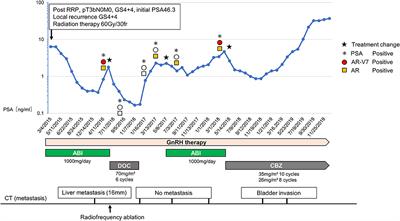 Abiraterone Rechallenge Based on Sequential Testing of Androgen Receptor Splice Variant 7 Expression in Circulating Tumor Cells: A Case Report